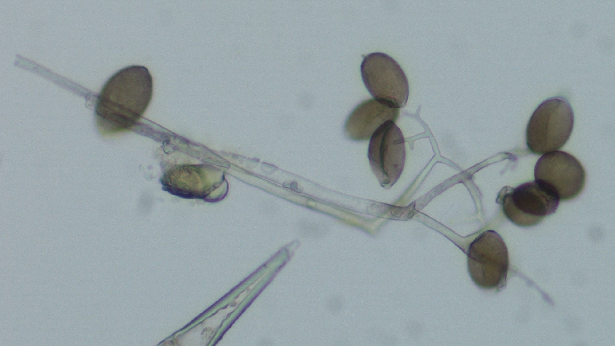 downy mildew spores magnified